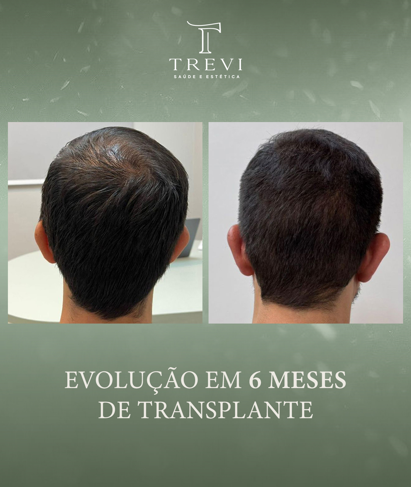 trevi01 - josimar - 6 meses