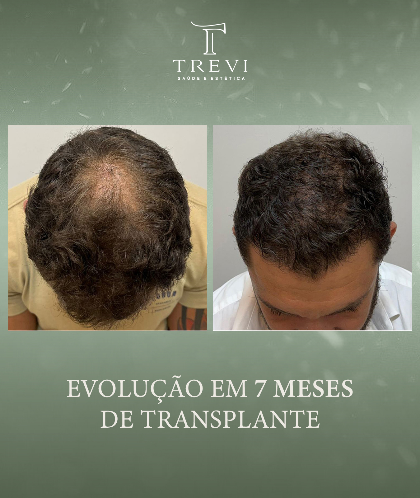 trevi01 - matheus - 7 meses