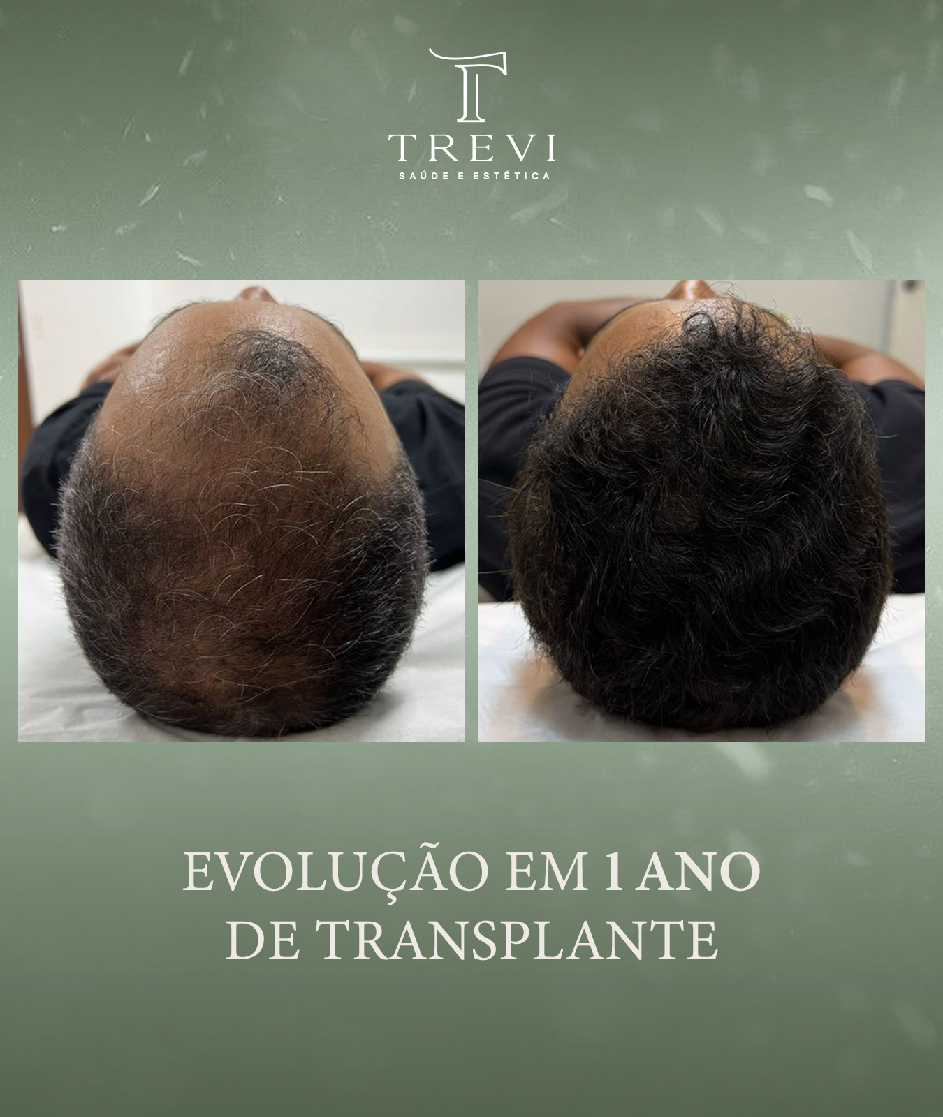 trevi02 - euclisio 1 ano