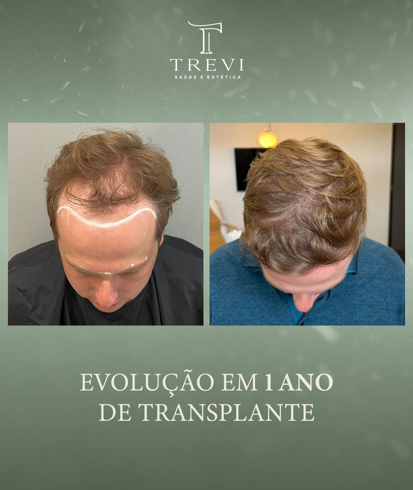 trevi02 - matheus - 1 ano