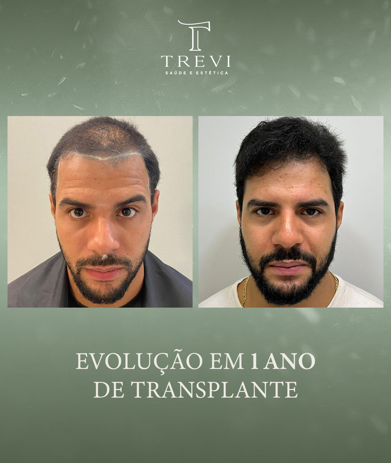 trevi03 - guilherme 1 ano