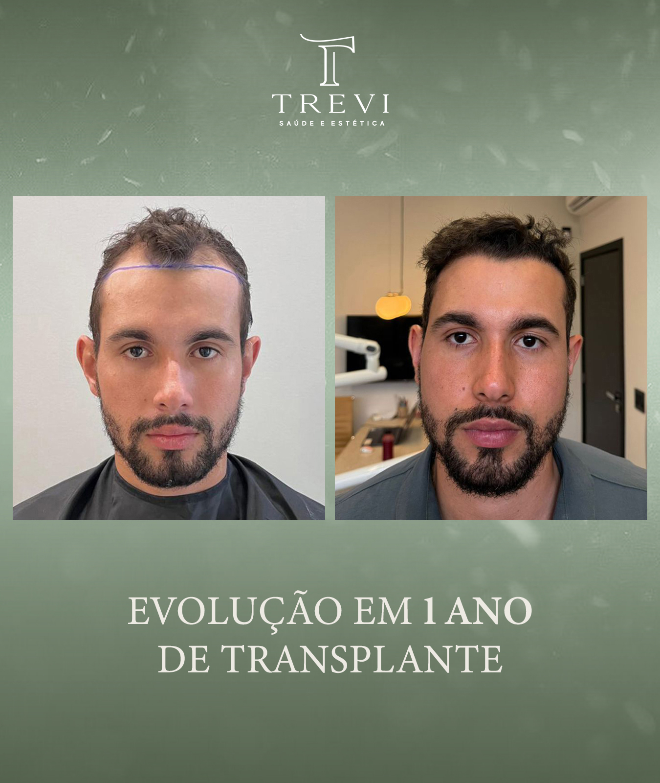 trevi03 - gustavo 1 ano