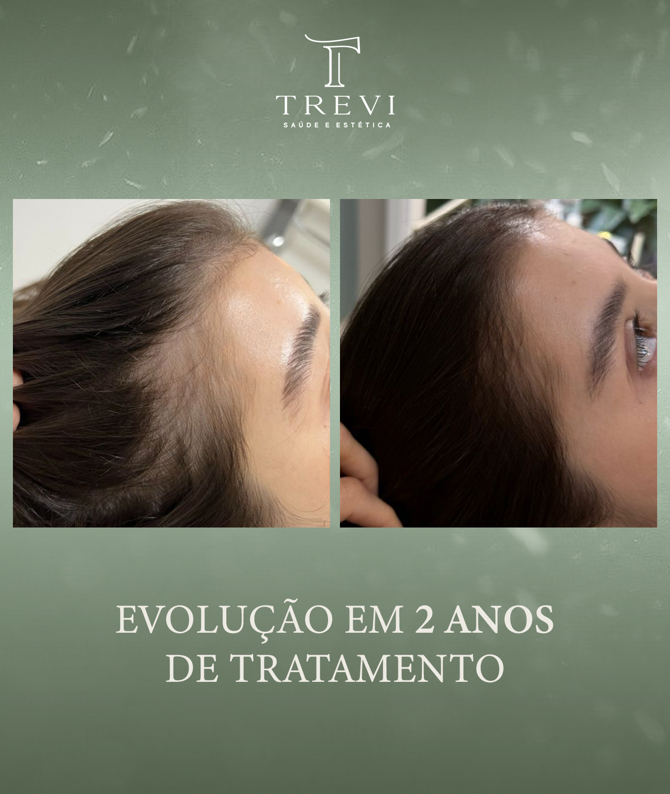 trevi03 - larissa - 2 anos