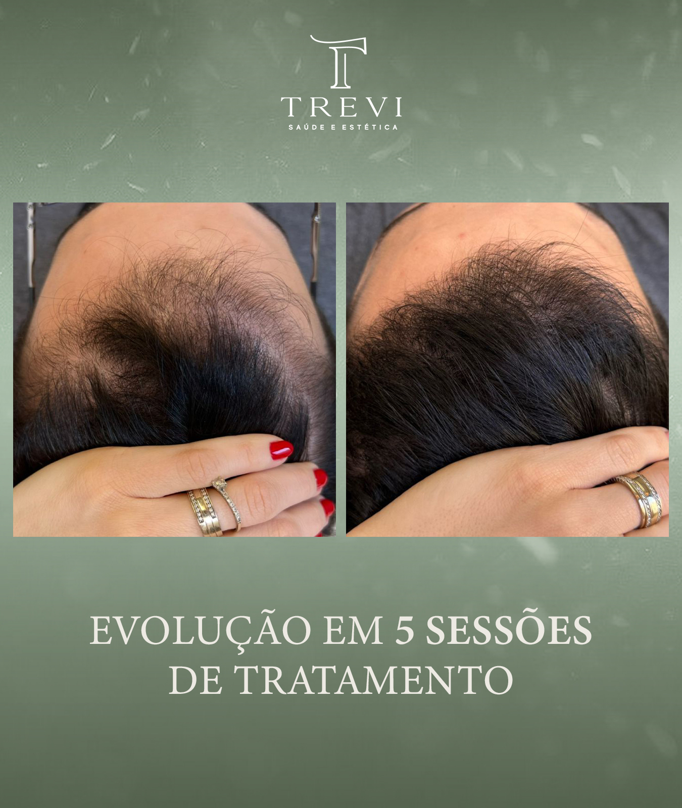 trevi05 - josimar - 5s